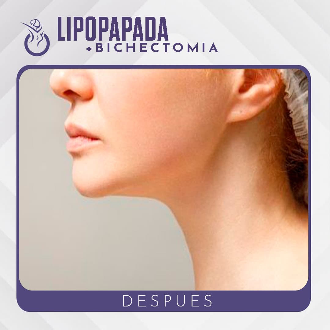 Después